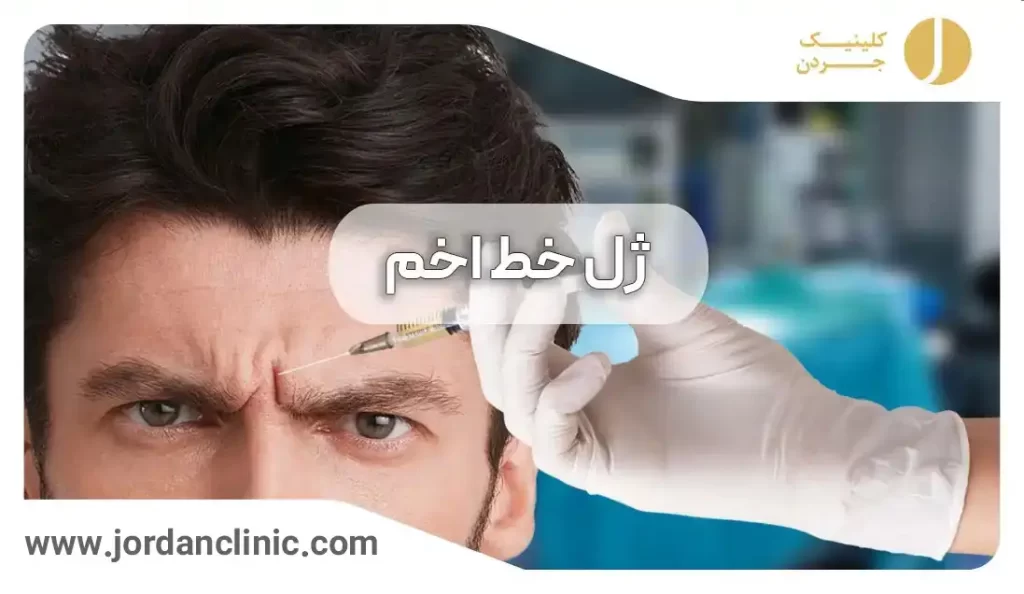 تزریق ژل به خط اخم آقایان