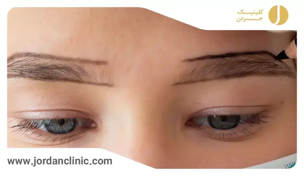 نحوه کاشت ابرو