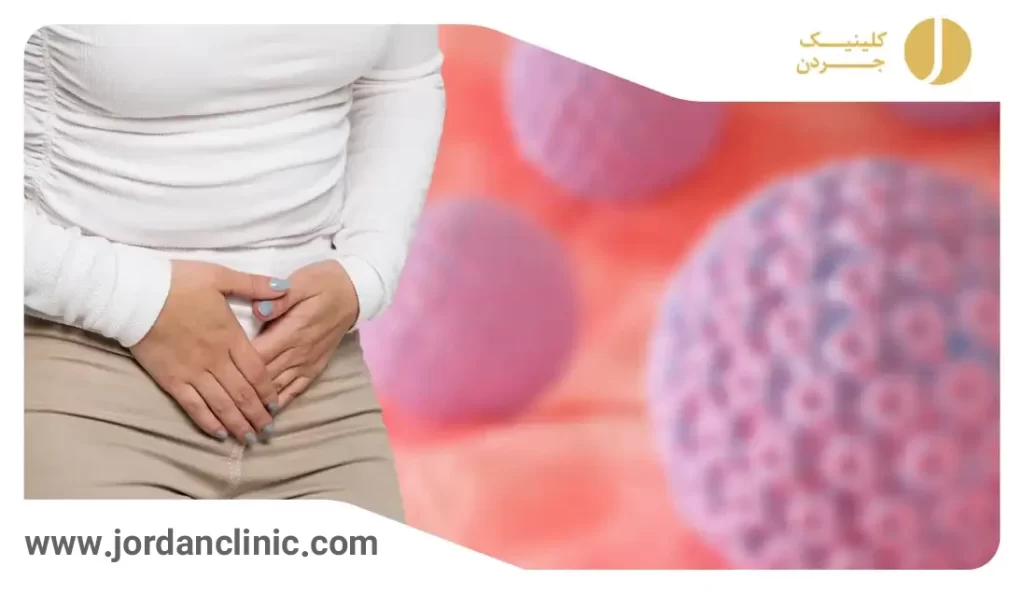 هرپس تناسلی