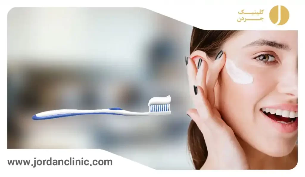 از بین بردن لک صورت با خمیردندان