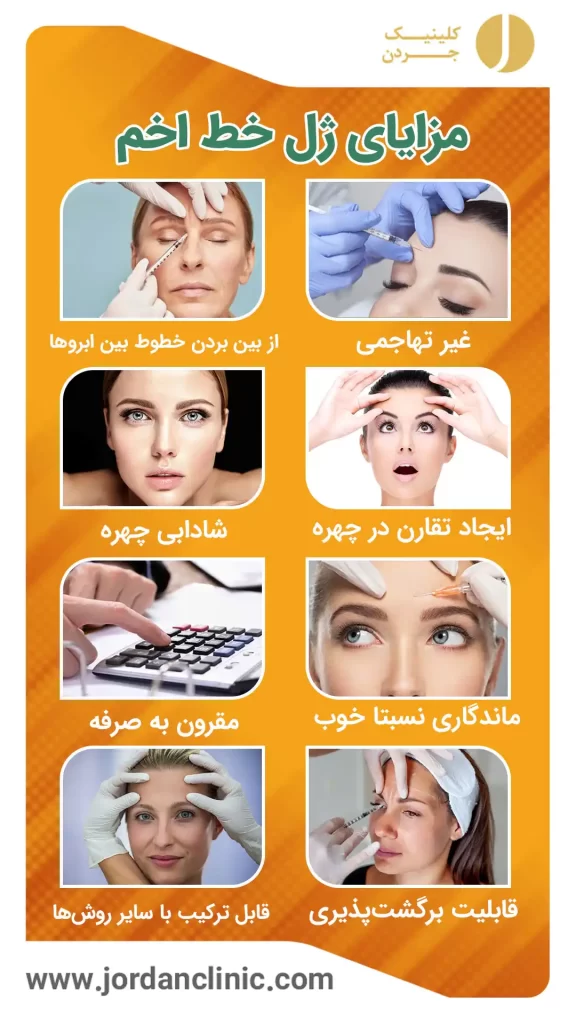 مزایای ژل خط اخم