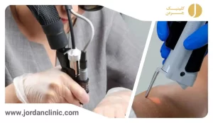 دستگاه لیزر موهای زائد الیت پلاس