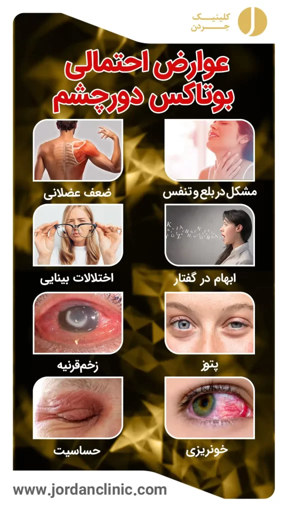 عوارض احتمالی بوتاکس دورچشم