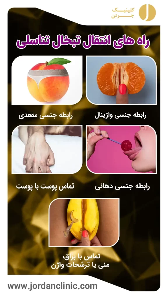 راه های انتقال تبخال تناسلی
